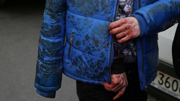 An inured person walks outside Sennaya Ploshchad metro station. Moscow metro authorities beefed up security after the blast in St Petersburg. (Anton Vaganov/REUTERS) An inured person walks outside Sennaya Ploshchad metro station. Moscow metro authorities beefed up security after the blast in St Petersburg. (Anton Vaganov/REUTERS)