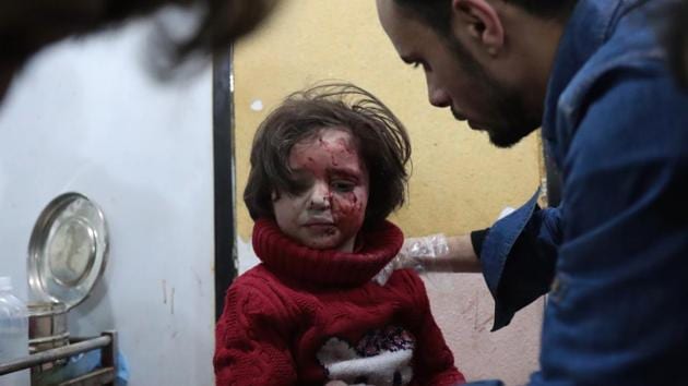 A Syrian girl receives treatment at a makeshift clinic following reported air strikes by government forces in the rebel-held town of Douma. (AFP Photo) A Syrian girl receives treatment at a makeshift clinic following reported air strikes by government forces in the rebel-held town of Douma. (AFP Photo)