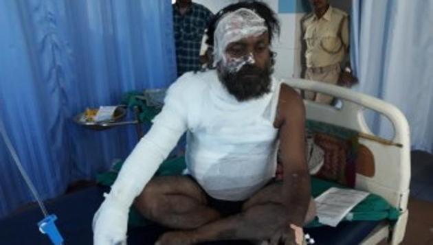 Suraj Baitha, who tried to immolate himself at Motihari is battling for life Patna Medical College Hospital . (Madnakar/HT file photo)) Suraj Baitha, who tried to immolate himself at Motihari is battling for life Patna Medical College Hospital . (Madnakar/HT file photo))