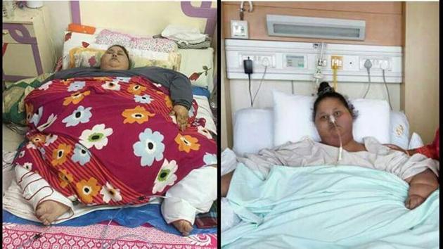 The hospital released before and after photographs of Eman Ahmed.(HT)