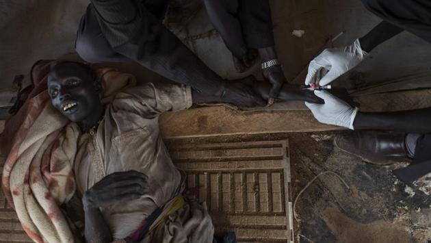 A patient with cholera is treated moments before his death at the temporary specialized hospital in Mingkaman, a camp for the Internally displaced people (IDPs) on April 26, 2017, in the Eastern Lakes States. Many of the displaced people have crosssed the Nile to reach the Mingkaman camp from neighbouring states. (AFP)