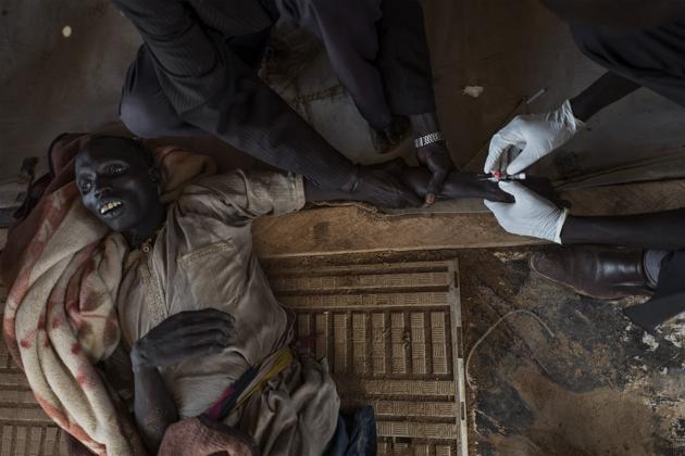 A patient with cholera is treated moments before his death at the temporary specialized hospital in Mingkaman, a camp for the Internally displaced people (IDPs) , in the Eastern Lakes States. A deadly outbreak of cholera has killed hundreds of people fleeing conflict in South Sudan. (AFP)