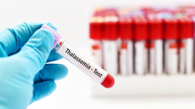 Reportedly, about four million Indians are thalassemia carriers.(Shutterstock)