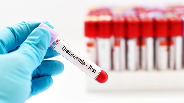 World Thalassemia Day is on May 8 (Shutterstock) World Thalassemia Day is on May 8 (Shutterstock)