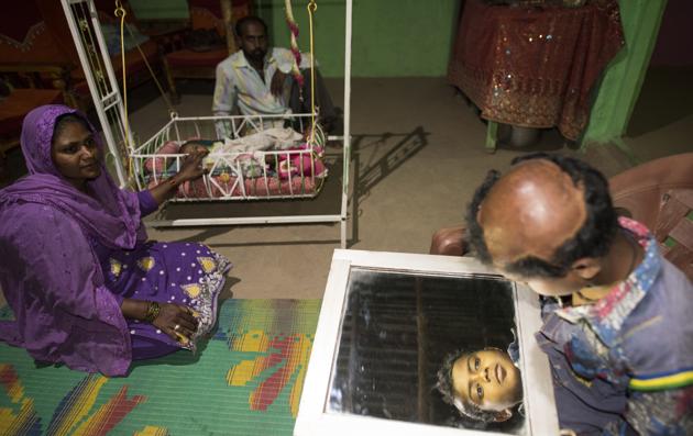 Asin Shah, 11, had his scalp torn away last December. His grandfather stepped in front of the bear to protect him, and died saving the boy’s life. He has since dropped out of school. He is too afraid to venture far from the house. “Asin’s scalp was hanging from his head,” remembers his father Yasin, 33. “He was so bad that the local hospital in Buldhana wouldn’t treat him. We spent all our Rs 3 lakh compensation on treatment in Aurangabad.” (Anshuman Poyrekar / HT Photo) Asin Shah, 11, had his scalp torn away last December. His grandfather stepped in front of the bear to protect him, and died saving the boy’s life. He has since dropped out of school. He is too afraid to venture far from the house. “Asin’s scalp was hanging from his head,” remembers his father Yasin, 33. “He was so bad that the local hospital in Buldhana wouldn’t treat him. We spent all our Rs 3 lakh compensation on treatment in Aurangabad.” (Anshuman Poyrekar / HT Photo)