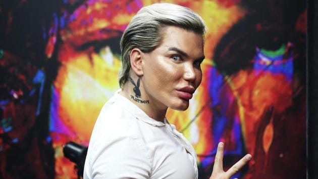 Rodrigo Alves, popularly known as human Ken has undergone 57 surgeries and more than 100 cosmetic procedures since he was 17-year-old. (Photo courtesy: Hangingshoesfilm.com) Rodrigo Alves, popularly known as human Ken has undergone 57 surgeries and more than 100 cosmetic procedures since he was 17-year-old. (Photo courtesy: Hangingshoesfilm.com)
