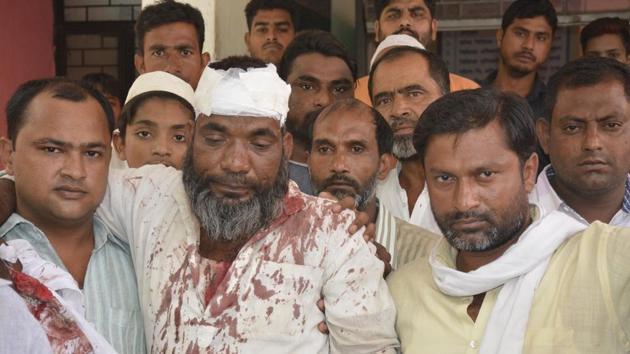 The victims were on their way to Naifal, near NH-24, from Dasna when three persons on an Apache rammed their bike. 48-year-old Shahabuddin was severely injured. (Sakib Ali/HT Photo) The victims were on their way to Naifal, near NH-24, from Dasna when three persons on an Apache rammed their bike. 48-year-old Shahabuddin was severely injured. (Sakib Ali/HT Photo)