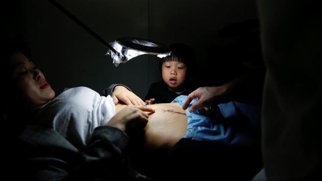 Grace Yuan's 3-year-old daughter Rebecca, looks at the caesarean delivery (C-section) scar on her mother's belly, which is being worked on by a tattoo artist, at Samurai Tattoo . As a dance teacher, she feels awkward when the scar is exposed as she wears dancing costumes. ‘Now I feel more confident after getting this tattoo. I can dance freely on the stage without worries or awkwardness,’ said Yuan. (Aly Song / Reuters) Grace Yuan's 3-year-old daughter Rebecca, looks at the caesarean delivery (C-section) scar on her mother's belly, which is being worked on by a tattoo artist, at Samurai Tattoo . As a dance teacher, she feels awkward when the scar is exposed as she wears dancing costumes. ‘Now I feel more confident after getting this tattoo. I can dance freely on the stage without worries or awkwardness,’ said Yuan. (Aly Song / Reuters)