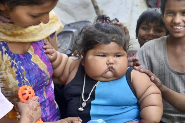 Chahat was born on July 24, 2016 via normal delivery. Her weight was normal, but she started gaining it when she was 4-month old (HT Photo) Chahat was born on July 24, 2016 via normal delivery. Her weight was normal, but she started gaining it when she was 4-month old (HT Photo)