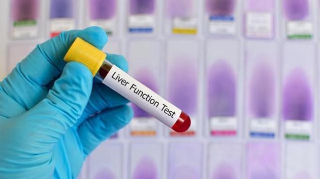 Under the ‘Mukh Mantri Punjab Hepatitis C Relief Fund’ scheme, every patient at the government hospitals undergoes the diagnosis.(Shutterstock)