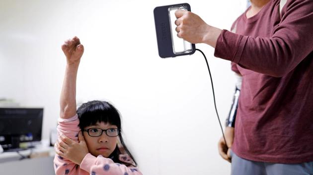 An engineer measures Angel Peng's hand, who injured her hand in a scalding accident. Traditional prosthetics are disadvantageous compared to 3D printed ones as they are expensive and need to be modified as a person grows older. (Tyrone Siu /REUTERS)