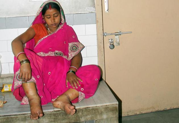 An anaemic patient — showing the symptom of swollen feet — at a hospital in Ludhiana. (HT File Photo) An anaemic patient — showing the symptom of swollen feet — at a hospital in Ludhiana. (HT File Photo)