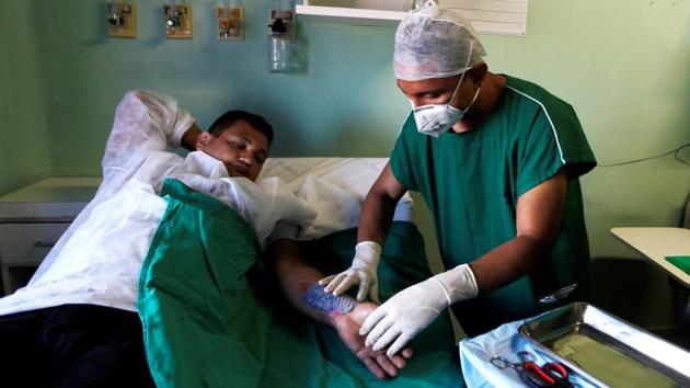 Photos: Brazilian doctors use Tilapia fish skin to treat burn victims