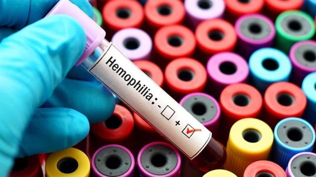 The members said that they had managed to procure 27 vials, which would most likely be used for patients currently admitted in the emergency wards of KEM Hospital, one of the six nodal centres for haemophilia treatment. (HT) The members said that they had managed to procure 27 vials, which would most likely be used for patients currently admitted in the emergency wards of KEM Hospital, one of the six nodal centres for haemophilia treatment. (HT)