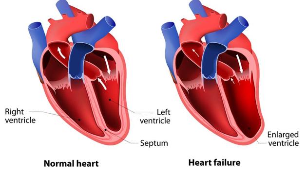 Scientists discover receptor protein linked to chronic heart failure ...