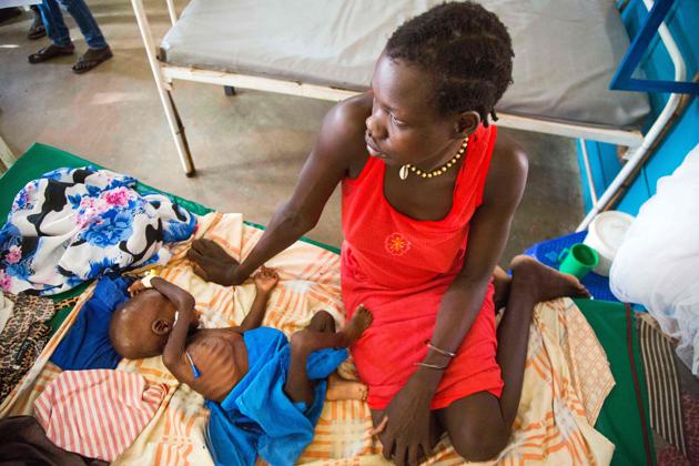 Awien Akol sits next to her one-year-old malnourished child at the Intensive Care Unit of the clinic run by Doctors Without Borders (MSF) in Aweil, Northern Bahr al Ghazal.  (Albert Gonzalez Farran / AFP) 