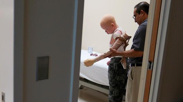 A 14 year old Tanzanian child with albinism gets help in an examination room during a prosthetic fitting at a hospital in Philadelphia. According to the World Health Organization, 1 in 1400 people in Tanzania suffer from the genetic disorder. (Carlo Allegri/REUTERS) A 14 year old Tanzanian child with albinism gets help in an examination room during a prosthetic fitting at a hospital in Philadelphia. According to the World Health Organization, 1 in 1400 people in Tanzania suffer from the genetic disorder. (Carlo Allegri/REUTERS)