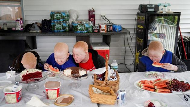 In the above photo, children have dinner at a charity operated temporary foster home in New York. Their travel and housing expenses were covered by a charity that helps children who have been injured in conflicts or disasters. (Carlo Allegri/REUTERS) In the above photo, children have dinner at a charity operated temporary foster home in New York. Their travel and housing expenses were covered by a charity that helps children who have been injured in conflicts or disasters. (Carlo Allegri/REUTERS)