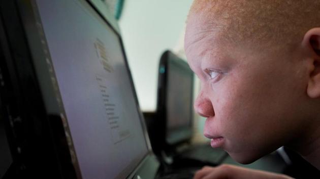 The United Nations estimates that at least 75 albinos were killed in Tanzania between 2000 and 2015. (Carlo Allegri/REUTERS) The United Nations estimates that at least 75 albinos were killed in Tanzania between 2000 and 2015. (Carlo Allegri/REUTERS)