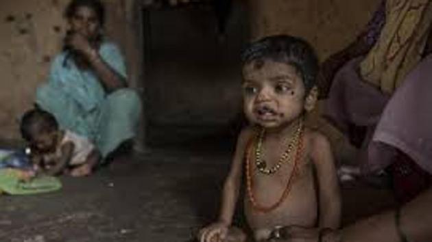 Last year, more than 300 children from Palghar died of malnutrition.