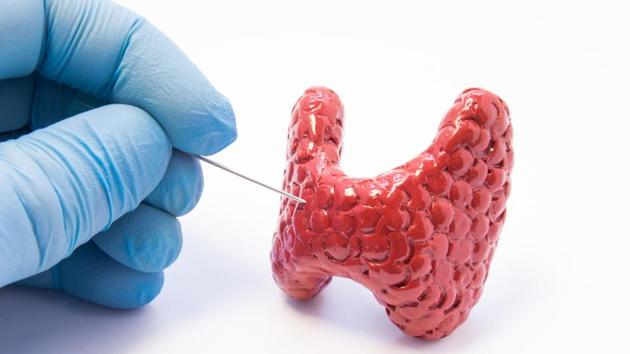 The guidelines are published in Journal of the American College of Radiology. (Shutterstock) The guidelines are published in Journal of the American College of Radiology. (Shutterstock)