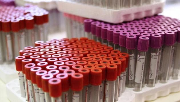 Results of a new study of breast and ovarian cancers can be used to estimate risks more precisely and determine at what age to start regular screening. (AFP) Results of a new study of breast and ovarian cancers can be used to estimate risks more precisely and determine at what age to start regular screening. (AFP)