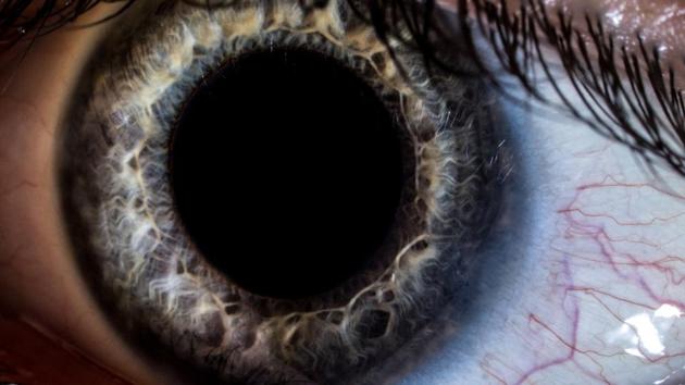 Over five million people across the world are patients affected by this condition, which causes lesions on the retina.(Mauro-Matacchione/Istock.com)