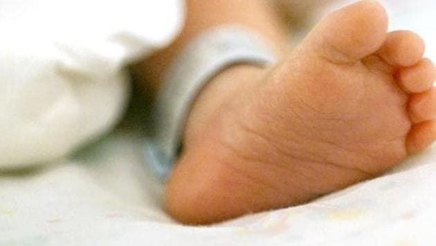 The baby was born with fours legs attached to his stomach. (File Photo) The baby was born with fours legs attached to his stomach. (File Photo)