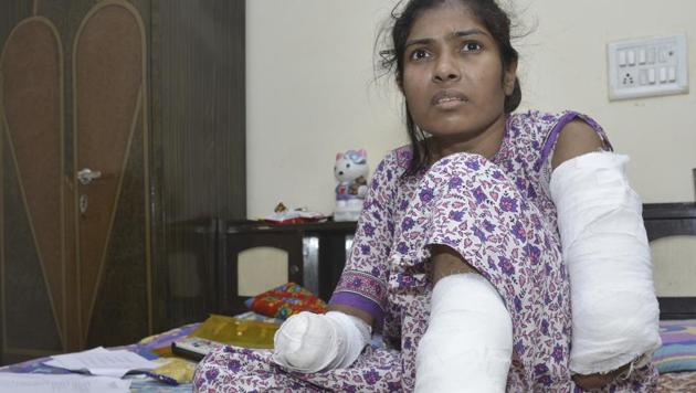 Neelam Kumari, 30, lost both hands after she came into contact with an 11 KV high-tension wire hanging outside the balcony of her flat in Ghaziabad. (Sakib Ali/HT Photo) Neelam Kumari, 30, lost both hands after she came into contact with an 11 KV high-tension wire hanging outside the balcony of her flat in Ghaziabad. (Sakib Ali/HT Photo)