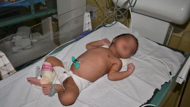 Girl child at a private hospital in Dhanbad (Bijay/ HT Photo) Girl child at a private hospital in Dhanbad (Bijay/ HT Photo)