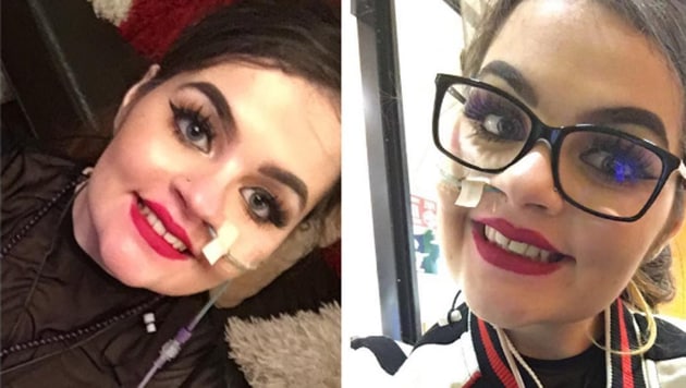 Emily Jones, a 22-year-old British who has a medical condition called Ehlers-Danlos syndrome (type 3).