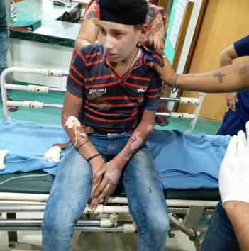 One of the injured boys. (Sakib Ali/HT Photo) One of the injured boys. (Sakib Ali/HT Photo)