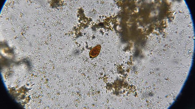 A microscopic image of flatworm egg at the University. Since changing eating habits is no easy task in a region where generations have followed this tradition, doctors are educating the younger generation with new school curriculum that uses cartoons against the use of raw fish. (Lillian Suwanrumpha/AFP) A microscopic image of flatworm egg at the University. Since changing eating habits is no easy task in a region where generations have followed this tradition, doctors are educating the younger generation with new school curriculum that uses cartoons against the use of raw fish. (Lillian Suwanrumpha/AFP)