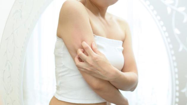Curious about the influence of the skin microbiome on the disease, the Penn-led team swabbed the skin of 44 Leishmania patients. (Shutterstock) Curious about the influence of the skin microbiome on the disease, the Penn-led team swabbed the skin of 44 Leishmania patients. (Shutterstock)