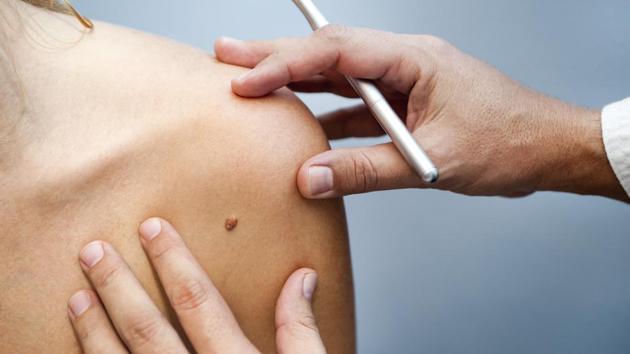 These are the first drug trials in humans with personalised vaccines directed at DNA mutations found in cancer cells. (iStock) These are the first drug trials in humans with personalised vaccines directed at DNA mutations found in cancer cells. (iStock)