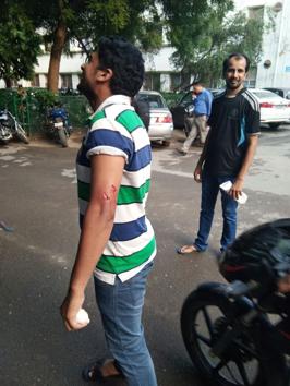 Three people were bitten by monkeys at AIIMS, Delhi yesterday. (Handout)