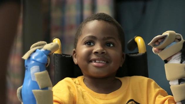 In this undated handout photo provided by the Children's Hospital of Philadelphia in Pennsylvania, Zion Harvey of Baltimore, Maryland posing with his newly transplanted hands. (AFP File Photo) In this undated handout photo provided by the Children's Hospital of Philadelphia in Pennsylvania, Zion Harvey of Baltimore, Maryland posing with his newly transplanted hands. (AFP File Photo)