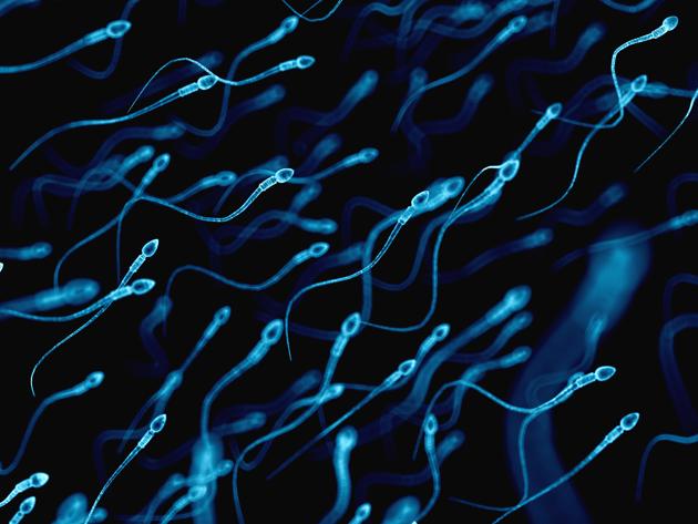 Medically accurate illustration of human sperms(Getty Images/iStockphoto) Medically accurate illustration of human sperms(Getty Images/iStockphoto)
