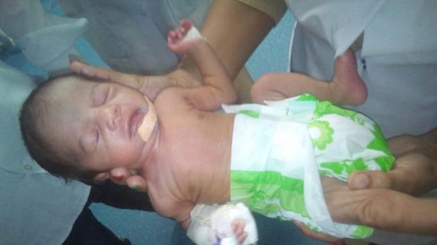 The girl child, who was born prematurely, is being looked after by the hospital staff for the last 27 days. The girl child, who was born prematurely, is being looked after by the hospital staff for the last 27 days.