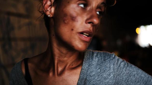 As more potent drugs like Fentanyl make their way to the streets, drug deaths in the United States have overtaken gun violence and car crash deaths combined. In light of such figures the commission argues for a state of emergency to allow for swift federal action in battling the opioid crisis as well as forcing Congress to pay attention to tis ‘scourge’. (Spencer Platt / Getty Images / AFP) As more potent drugs like Fentanyl make their way to the streets, drug deaths in the United States have overtaken gun violence and car crash deaths combined. In light of such figures the commission argues for a state of emergency to allow for swift federal action in battling the opioid crisis as well as forcing Congress to pay attention to tis ‘scourge’. (Spencer Platt / Getty Images / AFP)