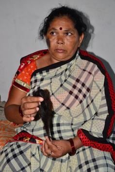 One of the alleged victims in Agra whose hair was chopped off.(HT Photo)