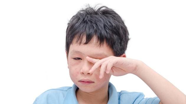 If left untreated, a food allergy can turn fatal, especially in children, because the body’s immune system considers the proteins and complex carbohydrates present in the food as foreign. (Shutterstock) If left untreated, a food allergy can turn fatal, especially in children, because the body’s immune system considers the proteins and complex carbohydrates present in the food as foreign. (Shutterstock)
