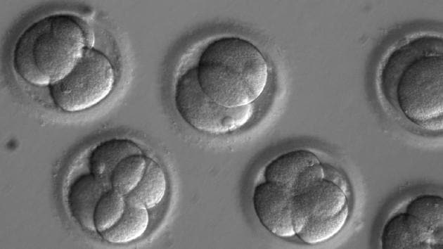 In this file photo, human embryos grow in a laboratory for a few days after researchers used gene editing technology to successfully repair a heart disease-causing genetic mutation. (AP Photo) In this file photo, human embryos grow in a laboratory for a few days after researchers used gene editing technology to successfully repair a heart disease-causing genetic mutation. (AP Photo)