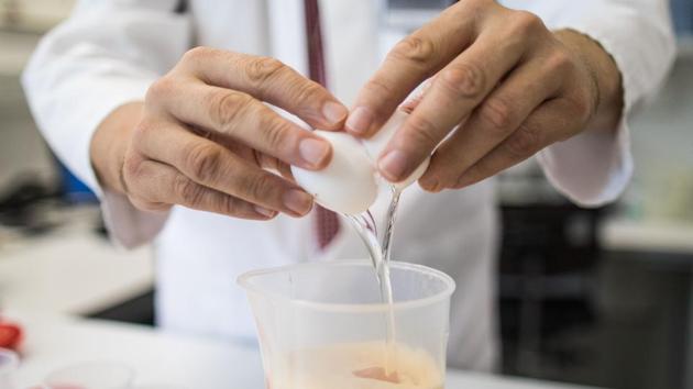 An employee of the Chemical veterinary examination office tests eggs for contamination by the insecticide fipronil in Krefeld, western Germany on August 7, 2017. (AFP) An employee of the Chemical veterinary examination office tests eggs for contamination by the insecticide fipronil in Krefeld, western Germany on August 7, 2017. (AFP)