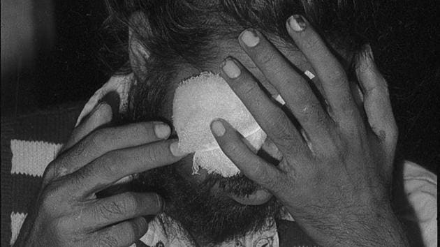In a period spanning 1979 to 1980, Bhagalpur in Bihar witnessed a series of incidents where undertrials or convicts were blinded by police by either pouring acid or piercing their eyes. The event, later known as the Bhagalpur Blindings stand as a jurisprudential landmark, as the first instance of the Indian Supreme Court ordering compensation for the violation of basic human rights. (Ajit Kumar / HT Archive) In a period spanning 1979 to 1980, Bhagalpur in Bihar witnessed a series of incidents where undertrials or convicts were blinded by police by either pouring acid or piercing their eyes. The event, later known as the Bhagalpur Blindings stand as a jurisprudential landmark, as the first instance of the Indian Supreme Court ordering compensation for the violation of basic human rights. (Ajit Kumar / HT Archive)