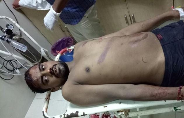 The attacker, Sanjay, in hospital. The attacker, Sanjay, in hospital.