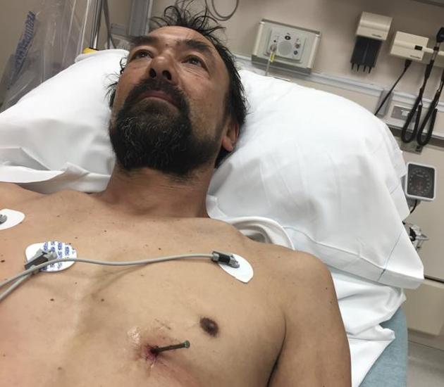 This photo provided by Donna Bergeson on June 25, 2017, her husband Doug Bergeson lies on a hospital bed at Aurora BayCare Medical Center in Green Bay, Wisconsin, before a doctor removed a nail from his heart. (AP Photo) This photo provided by Donna Bergeson on June 25, 2017, her husband Doug Bergeson lies on a hospital bed at Aurora BayCare Medical Center in Green Bay, Wisconsin, before a doctor removed a nail from his heart. (AP Photo)