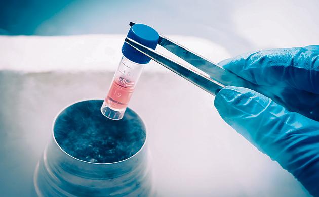The Pros and Cons of Stem Cell Banking