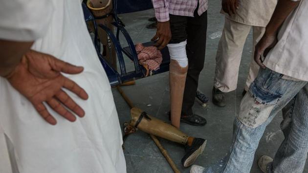 New fittings can be done quickly and free of charge by the charity itself with the help of donations. BMVSS manages to produce around 50 prostheses a day and fits them as well. (Chandan Khanna / AFP)