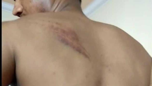 Army man Anuj Kumar Sharma was allegedly beaten up by policemen in Jewar on August 24 evening. (HT Photo) Army man Anuj Kumar Sharma was allegedly beaten up by policemen in Jewar on August 24 evening. (HT Photo)